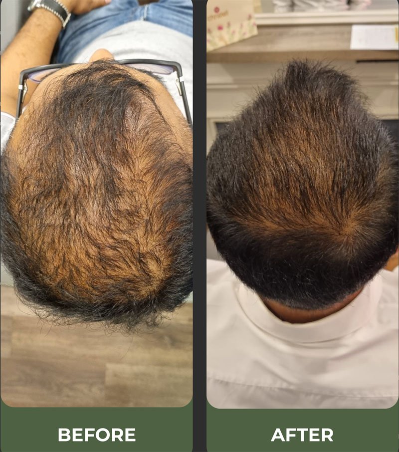 Christell Luxury Wellness වෙතින් මෙරට ප්‍රථම වරට හිස කෙස් වර්ධනය සඳහා නවතම ප්‍රතිකාර රැසක් Hair Lab වෙතින්